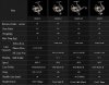 2015-exist-specs.jpg